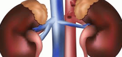 केएमसीले गरिब तथा असहाय तीन जना विरामीको निःशुल्क मिर्गौला प्रत्यारोपण गर्ने