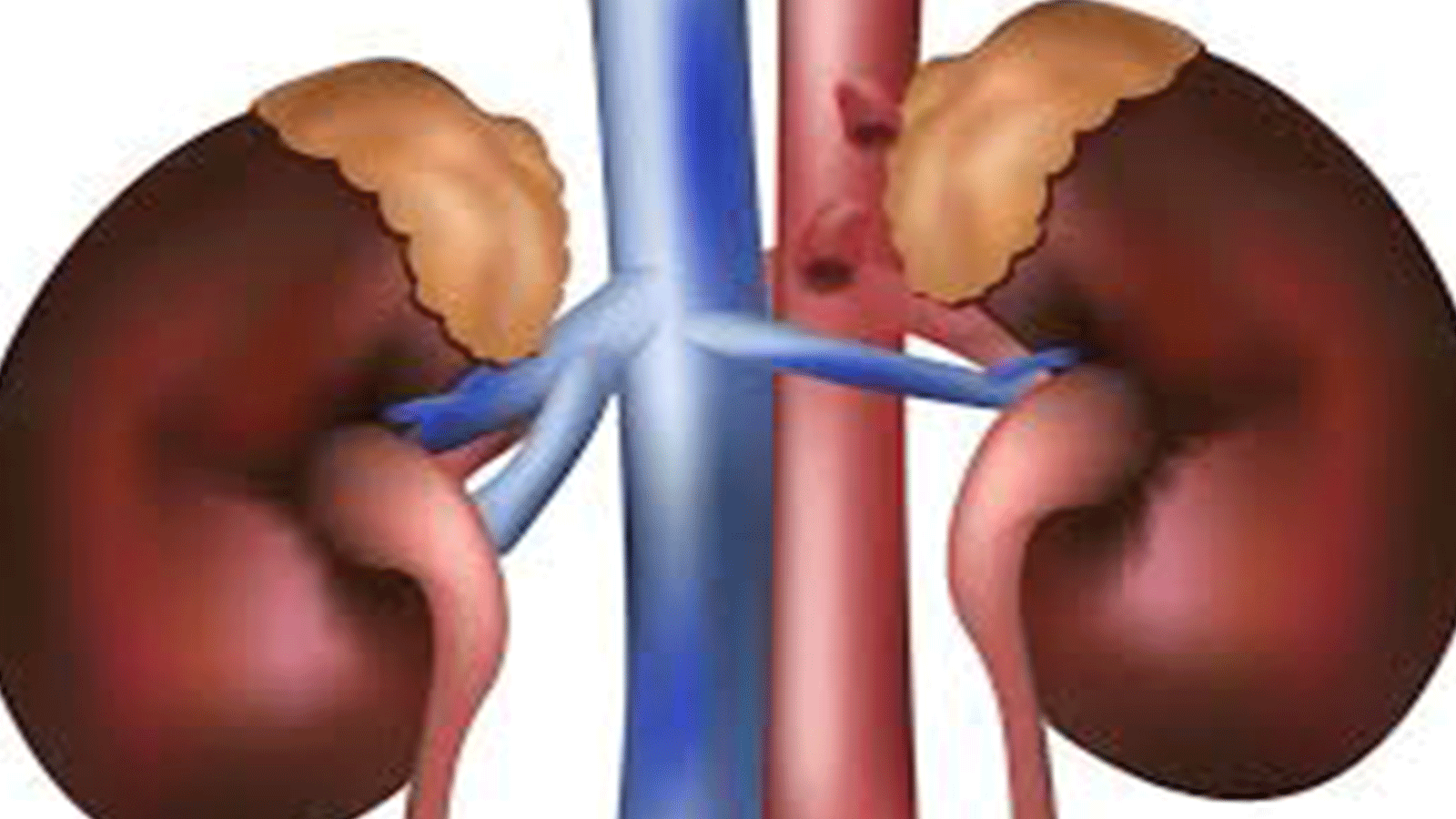 केएमसीले गरिब तथा असहाय तीन जना विरामीको निःशुल्क मिर्गौला प्रत्यारोपण गर्ने